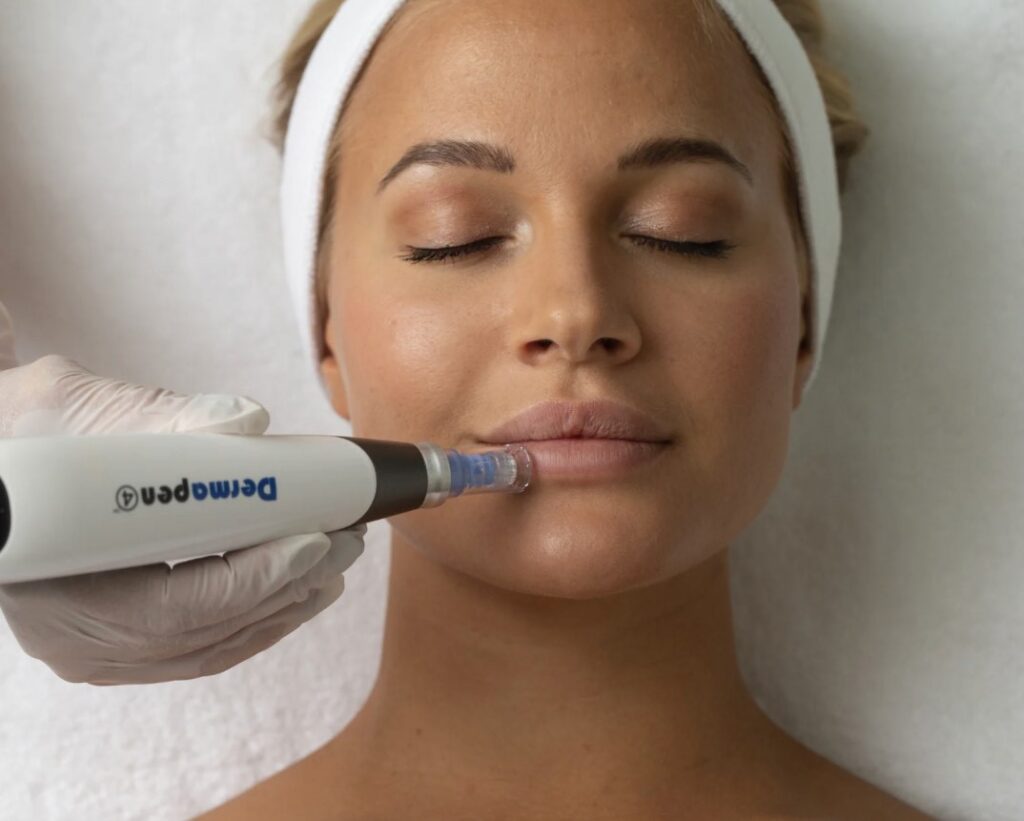dermapen skin microneedling melbourne